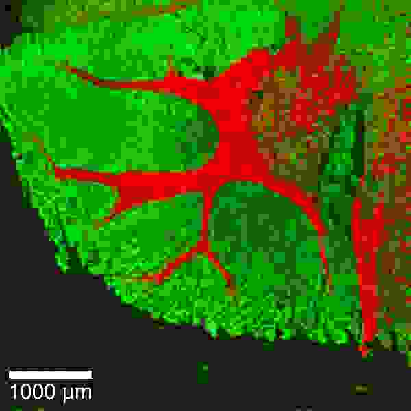 Konfokales Raman-Bild von Hirngewebe eines Hamsters.