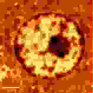 SNOM-Bild eines Zellkerns.
