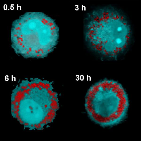 Lipidtröpfchen in Makrophagen